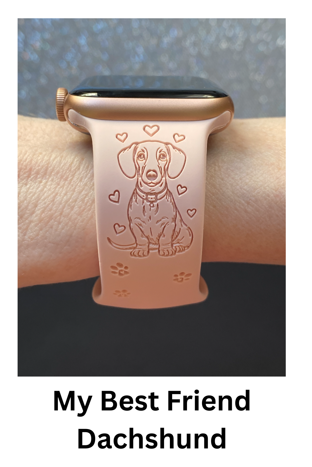 Dog Breed (#3) Fitbit Versa 1/Versa 2 Watch Band